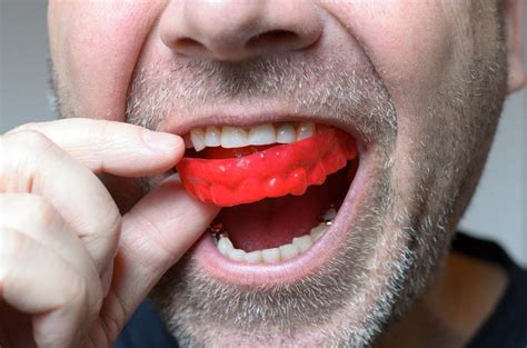 The Importance of Wearing a Mouthguard in Albion During .